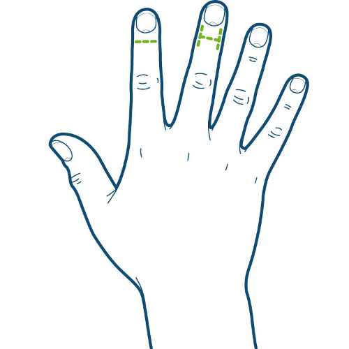 Mallet finger 3